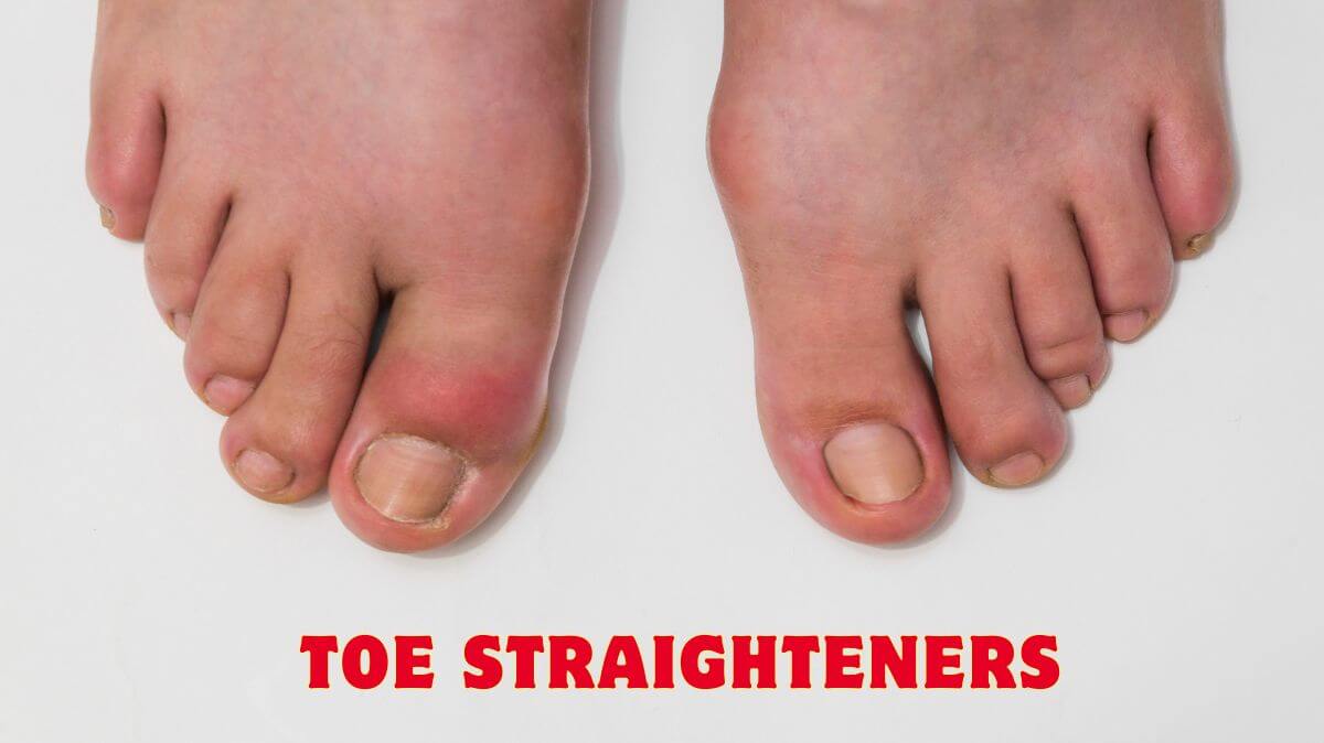 Toe Straighteners: Your Solution to Foot Pain